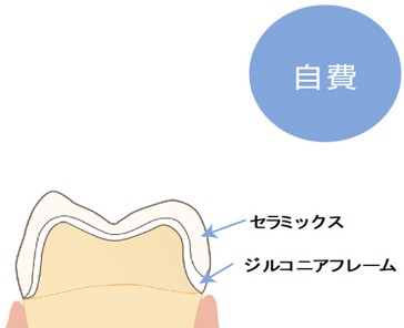 日本顎顔面補綴学会